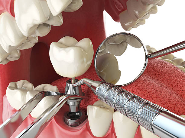 Best Emergency Dental Surgery in Ruleville, MS